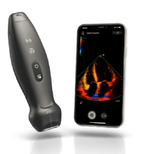Mengenal Pocket Echo Ultrasound: Inovasi USG Portabel 