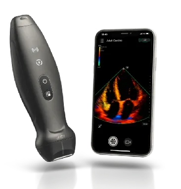 Apa Itu POCUS (Point-of-Care Ultrasound)