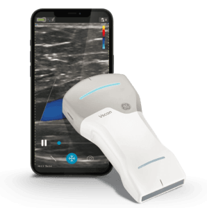 Mengenal Pocket Echo Ultrasound: Inovasi USG Portabel 