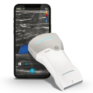 Mengenal Pocket Echo Ultrasound: Inovasi USG Portabel