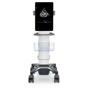 Mindray Ultrasound : Jenis, Spesifikasi dan Kegunaannya