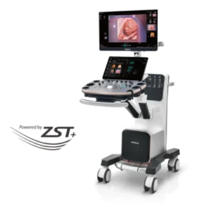Mindray Ultrasound : Jenis, Spesifikasi dan Kegunaannya
