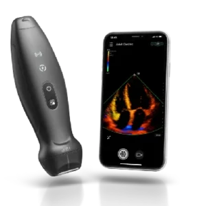 Mindray Ultrasound : Jenis, Spesifikasi dan Kegunaannya