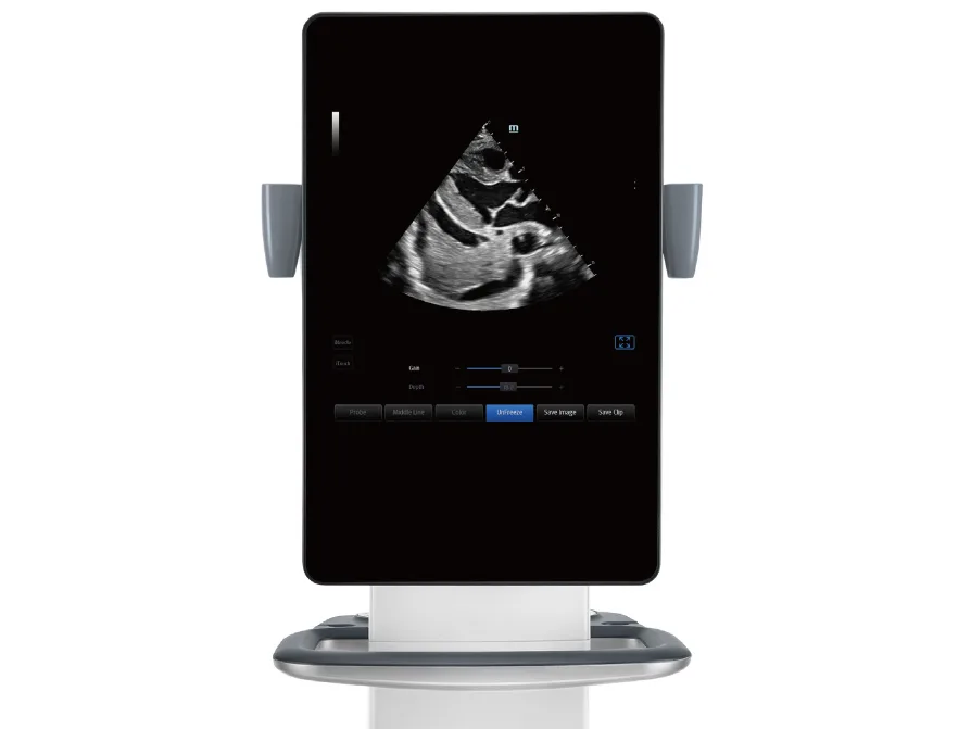 te9 pocus mindray te9 pocus mindray