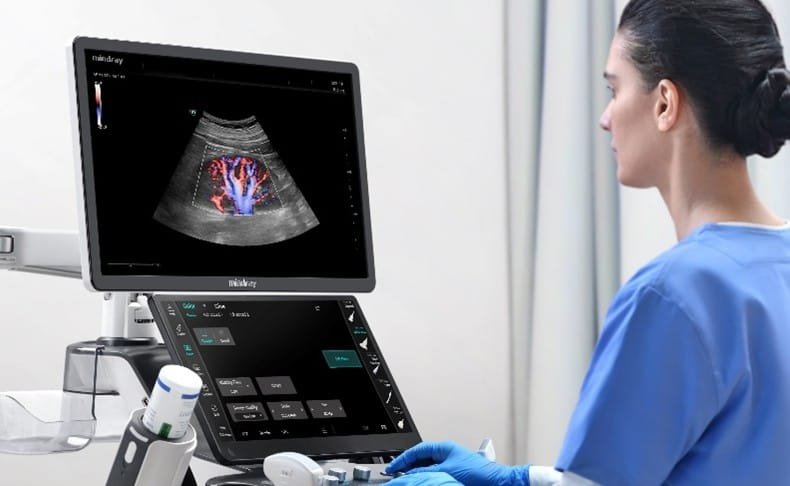 Consona USG Mindray Brochure, Datasheet & Price Terbaru