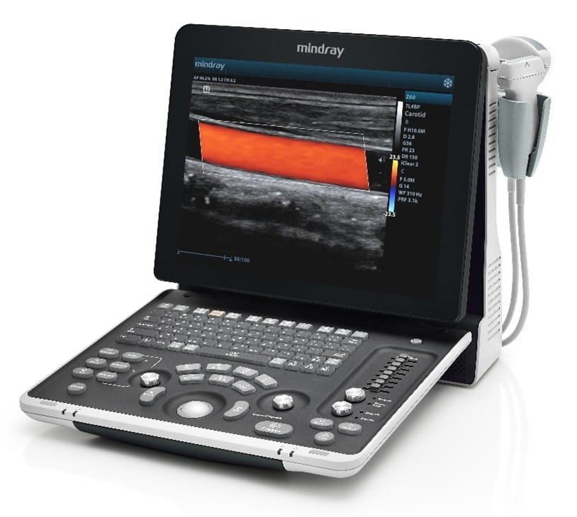 Cara Menggunakan Mindray Z60 Manual dengan Mudah