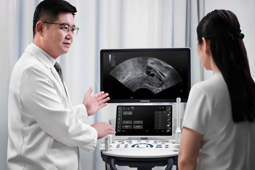 USG 4D Hitam Putih untuk Diagnosa yang Lebih Baik