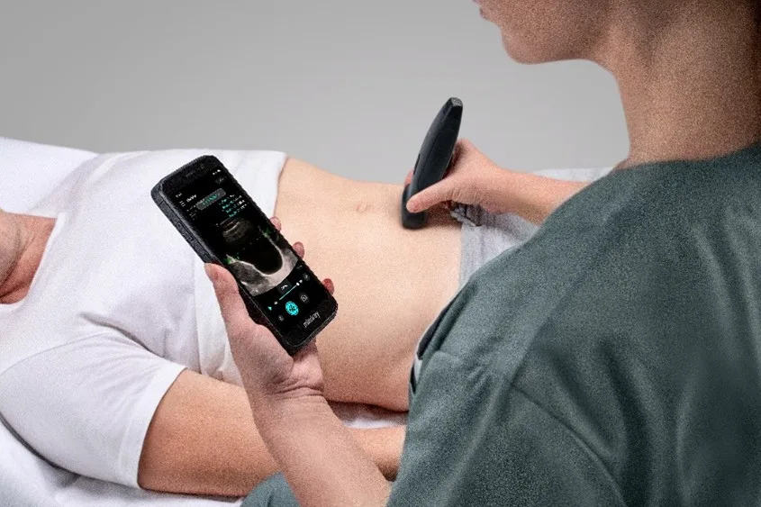 Review Lengkap TE Air Ultrasound