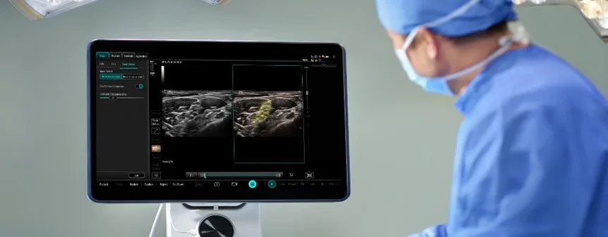 Spesifikasi Lengkap TEX20 Ultrasound Mindray