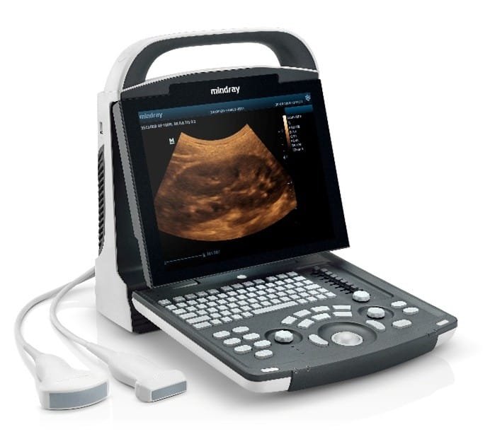 8 Pengertian Mindray DP 10 Ultrasound yang Wajib Diketahui