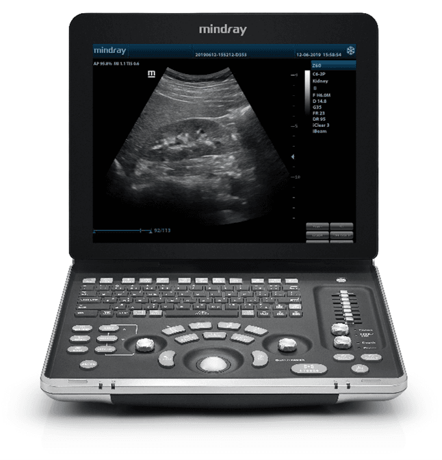 Review Mindray Z60 Ultrasound System Profesional