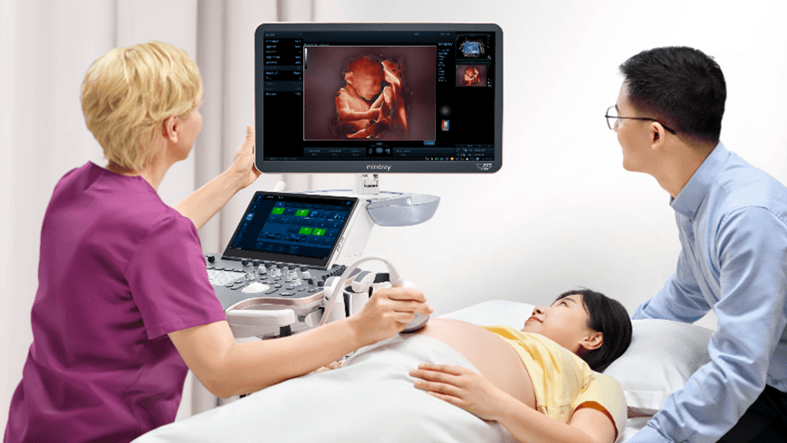 Keunggulan Teknologi Canggih pada NUEWA