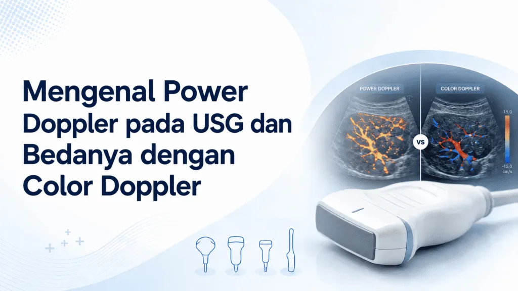Power Doppler pada USG dan Bedanya dengan Color Doppler